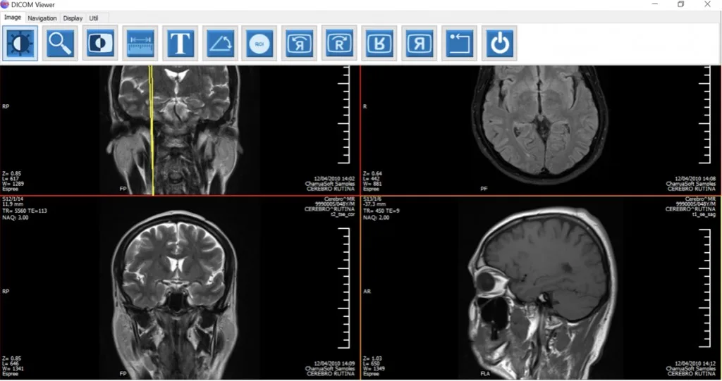 Charrua WorkStation DICOM Viewer with a viewing toolbar and four brain-image panes