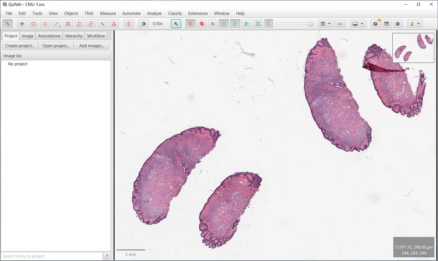 QuPath on Windows displaying the CMU-1.svs tissue slide, analysis tabs, annotation toolbar and overview inset.